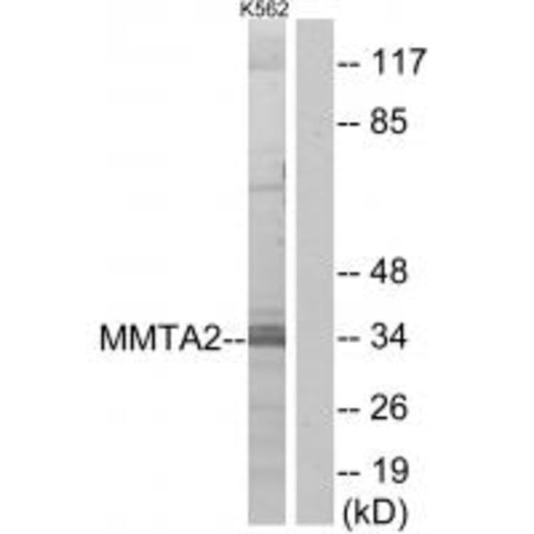 Western blot - MMTA2 Antibody from Signalway Antibody (34045) - Antibodies.com