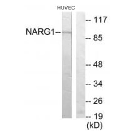 Western blot - NARG1 Antibody from Signalway Antibody (34048) - Antibodies.com