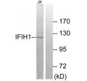 Western blot - IFIH1 Antibody from Signalway Antibody (34051) - Antibodies.com