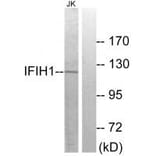 Western blot - IFIH1 Antibody from Signalway Antibody (34051) - Antibodies.com