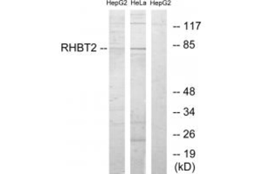 Western blot - RHBT2 Antibody from Signalway Antibody (34052) - Antibodies.com