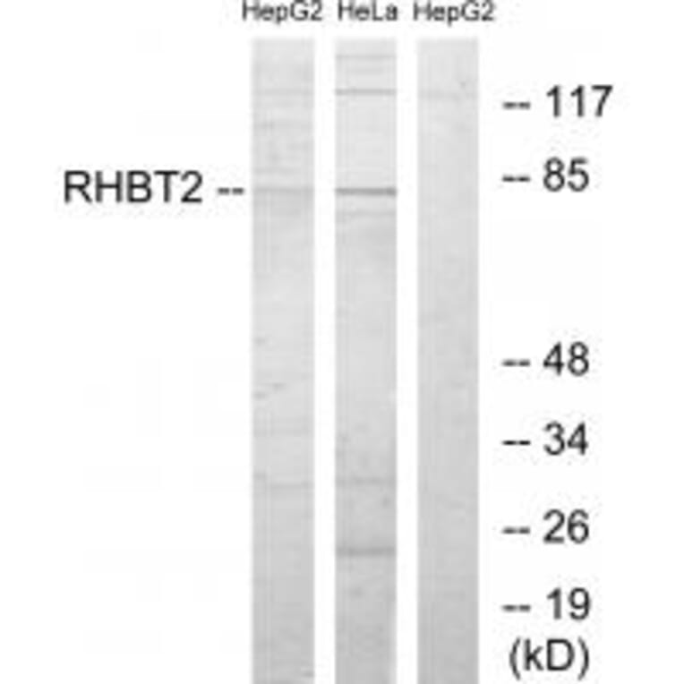 Western blot - RHBT2 Antibody from Signalway Antibody (34052) - Antibodies.com