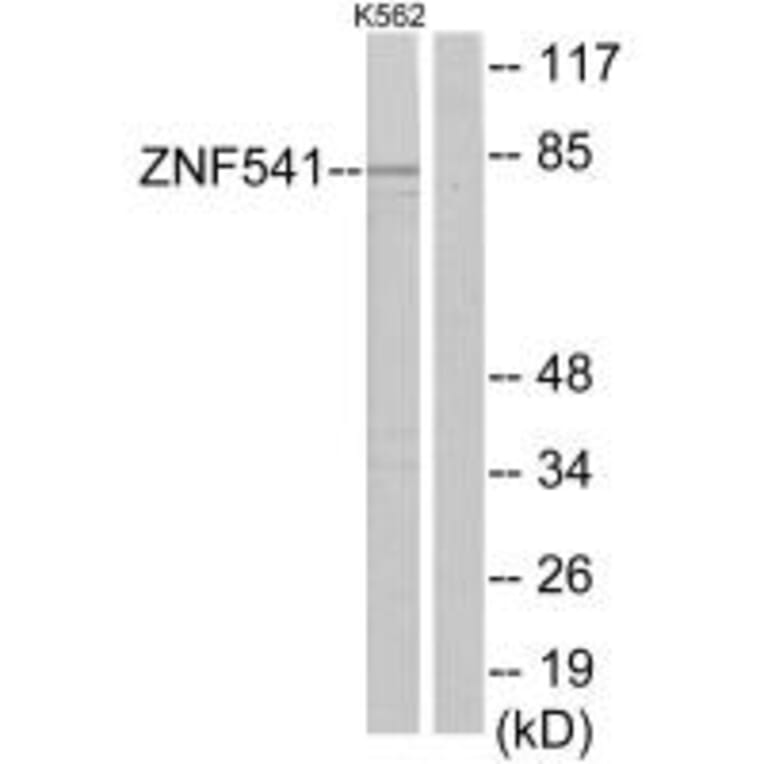 Western blot - ZNF541Antibody from Signalway Antibody (34058) - Antibodies.com