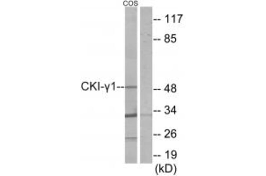 Western blot - CKI-γ1 Antibody from Signalway Antibody (34073) - Antibodies.com