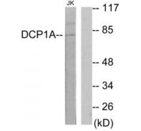 Western blot - DCP1A Antibody from Signalway Antibody (34074) - Antibodies.com