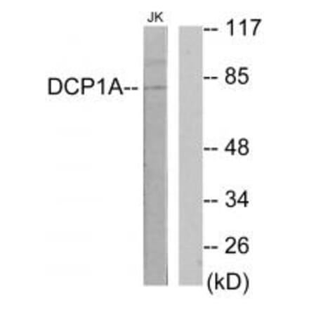 Western blot - DCP1A Antibody from Signalway Antibody (34074) - Antibodies.com