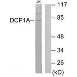 Western blot - DCP1A Antibody from Signalway Antibody (34074) - Antibodies.com