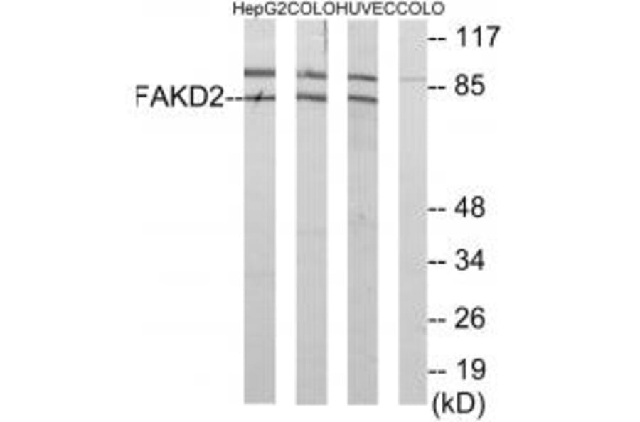 Western blot - FAKD2 Antibody from Signalway Antibody (34084) - Antibodies.com