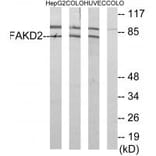 Western blot - FAKD2 Antibody from Signalway Antibody (34084) - Antibodies.com
