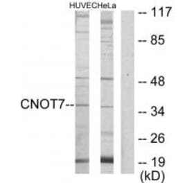 Western blot - CNOT7 Antibody from Signalway Antibody (34108) - Antibodies.com