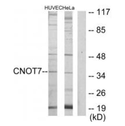 Western blot - CNOT7 Antibody from Signalway Antibody (34108) - Antibodies.com