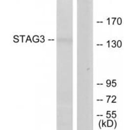 Western blot - STAG3 Antibody from Signalway Antibody (34109) - Antibodies.com