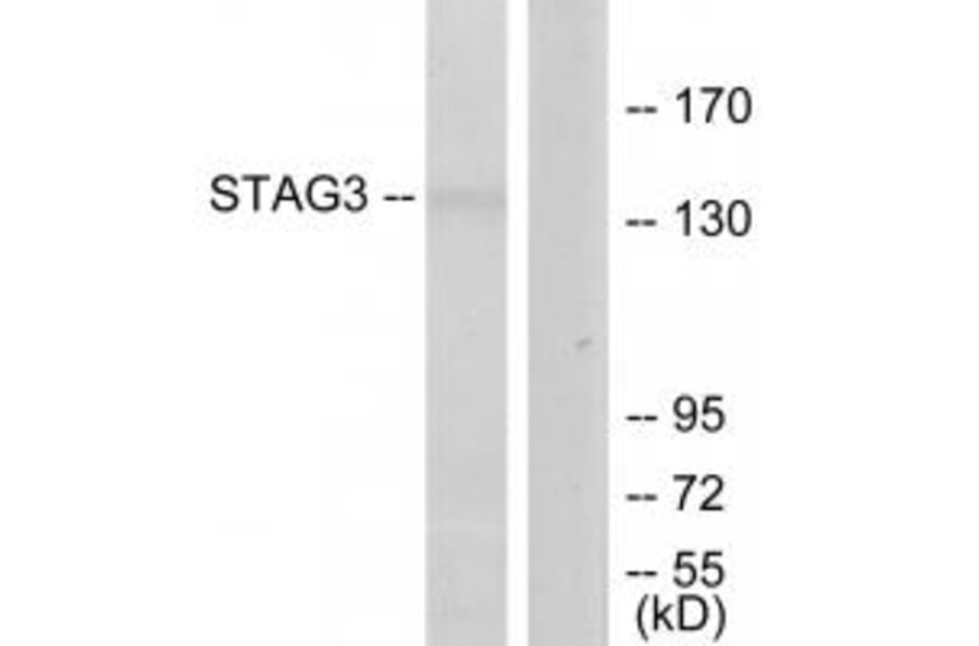 Western blot - STAG3 Antibody from Signalway Antibody (34109) - Antibodies.com