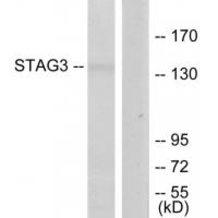 Western blot - STAG3 Antibody from Signalway Antibody (34109) - Antibodies.com