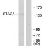 Western blot - STAG3 Antibody from Signalway Antibody (34109) - Antibodies.com
