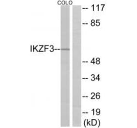 Western blot - IKZF3 Antibody from Signalway Antibody (34112) - Antibodies.com