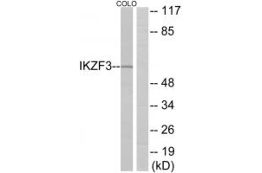 Western blot - IKZF3 Antibody from Signalway Antibody (34112) - Antibodies.com
