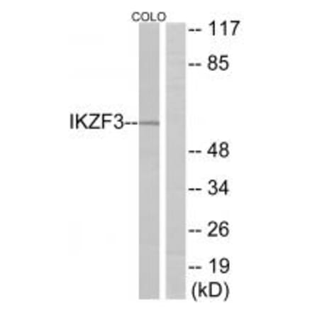 Western blot - IKZF3 Antibody from Signalway Antibody (34112) - Antibodies.com