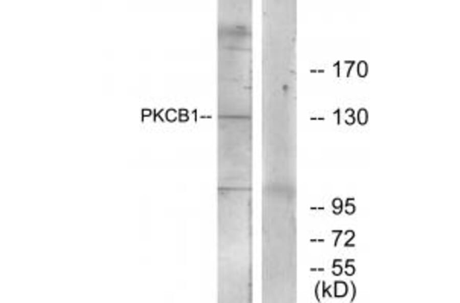 Western blot - PKCB1 Antibody from Signalway Antibody (34116) - Antibodies.com
