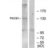 Western blot - PKCB1 Antibody from Signalway Antibody (34116) - Antibodies.com
