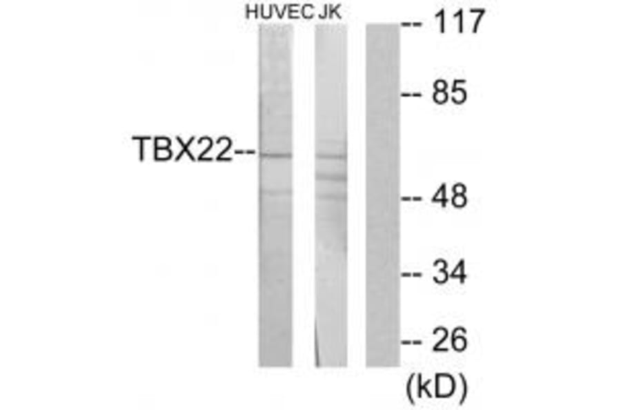 Western blot - TBX22 Antibody from Signalway Antibody (34134) - Antibodies.com