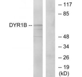 Western blot - DYR1B Antibody from Signalway Antibody (34135) - Antibodies.com