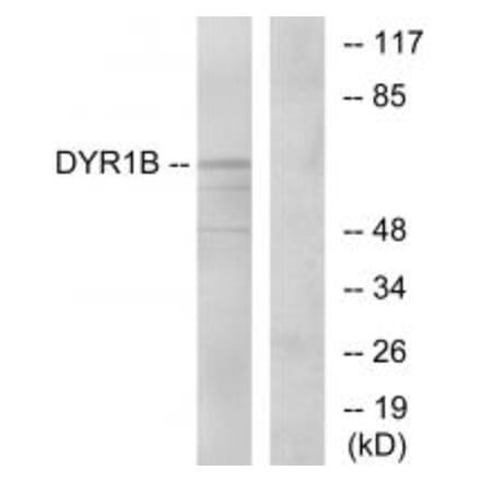 Western blot - DYR1B Antibody from Signalway Antibody (34135) - Antibodies.com