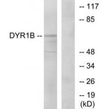 Western blot - DYR1B Antibody from Signalway Antibody (34135) - Antibodies.com