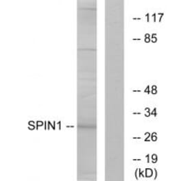 Western blot - SPIN1 Antibody from Signalway Antibody (34139) - Antibodies.com