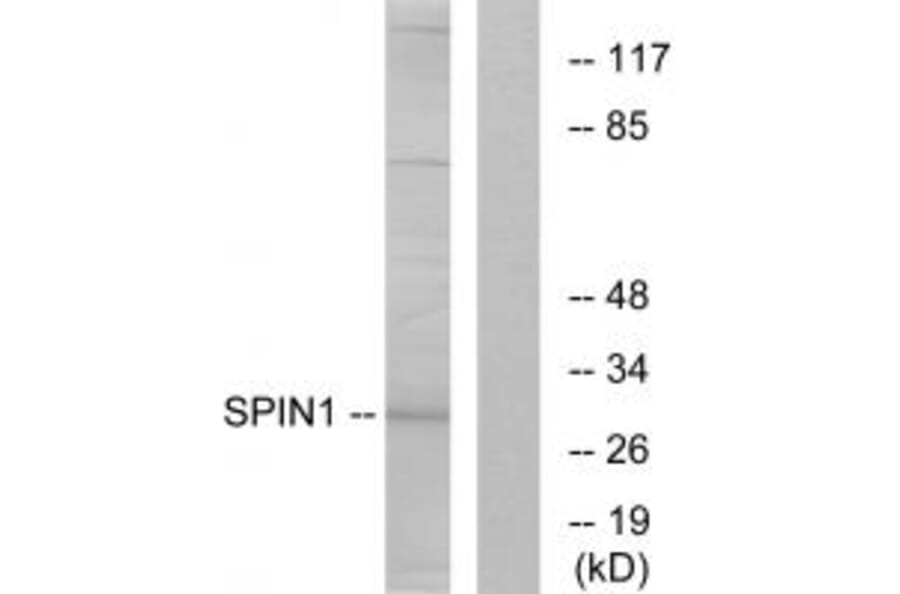 Western blot - SPIN1 Antibody from Signalway Antibody (34139) - Antibodies.com