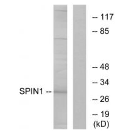 Western blot - SPIN1 Antibody from Signalway Antibody (34139) - Antibodies.com