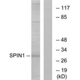 Western blot - SPIN1 Antibody from Signalway Antibody (34139) - Antibodies.com