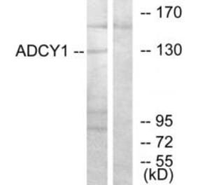 Western blot - ADCY1 Antibody from Signalway Antibody (34159) - Antibodies.com