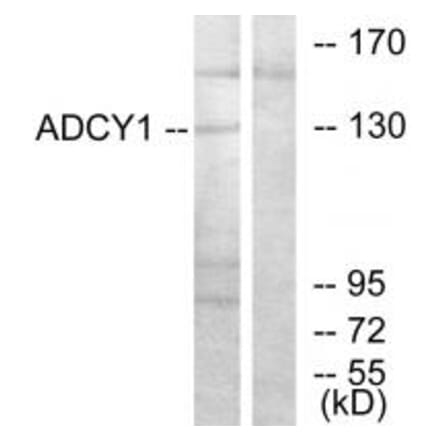 Western blot - ADCY1 Antibody from Signalway Antibody (34159) - Antibodies.com