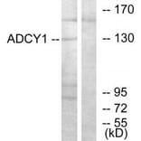 Western blot - ADCY1 Antibody from Signalway Antibody (34159) - Antibodies.com