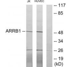 Western blot - ARRB1 Antibody from Signalway Antibody (34167) - Antibodies.com