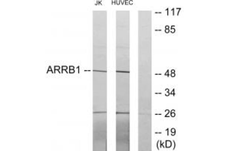 Western blot - ARRB1 Antibody from Signalway Antibody (34167) - Antibodies.com