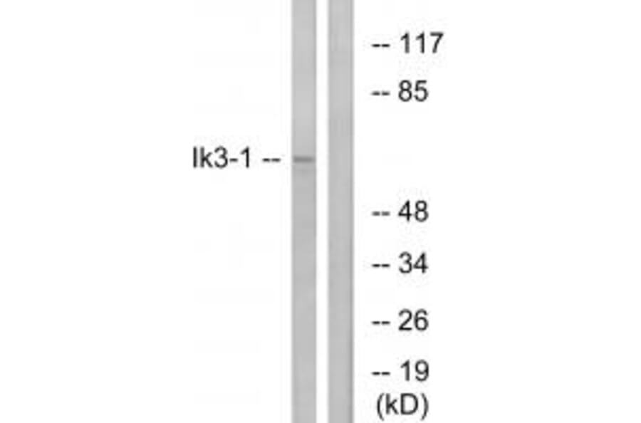 Western blot - Ik3-1 Antibody from Signalway Antibody (34172) - Antibodies.com