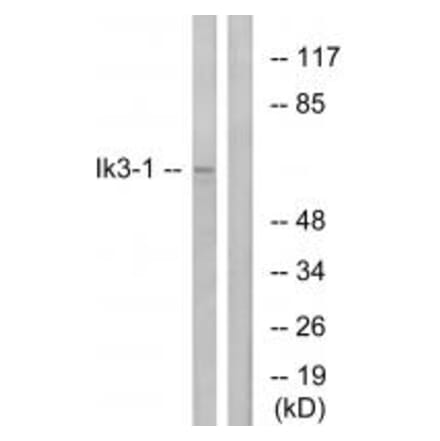 Western blot - Ik3-1 Antibody from Signalway Antibody (34172) - Antibodies.com