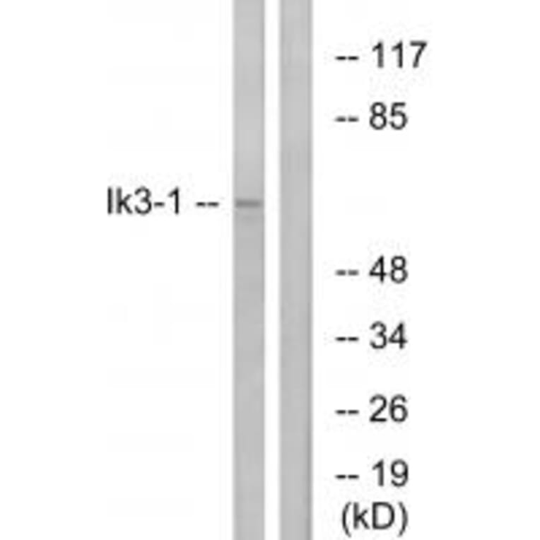 Western blot - Ik3-1 Antibody from Signalway Antibody (34172) - Antibodies.com