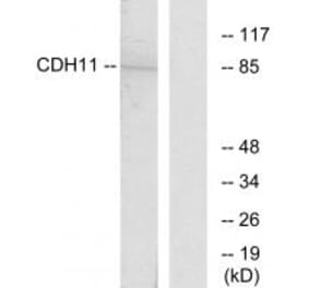 Western blot - CDH11 Antibody from Signalway Antibody (34175) - Antibodies.com
