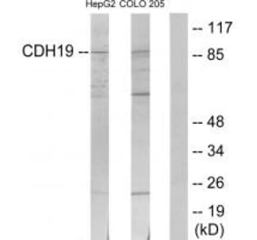 Western blot - CDH19 Antibody from Signalway Antibody (34178) - Antibodies.com