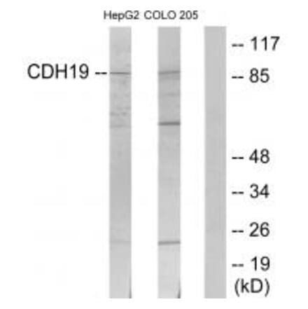 Western blot - CDH19 Antibody from Signalway Antibody (34178) - Antibodies.com