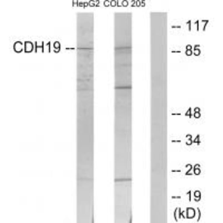 Western blot - CDH19 Antibody from Signalway Antibody (34178) - Antibodies.com