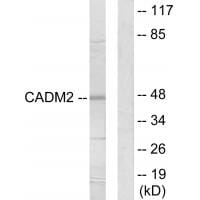 Western blot analysis of extracts from HepG2 cells, using CADM2 antibody #34182.
