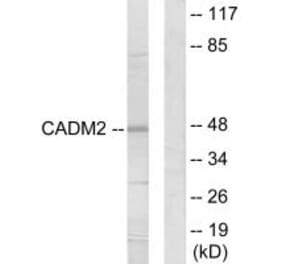 Western blot - CADM2 Antibody from Signalway Antibody (34182) - Antibodies.com