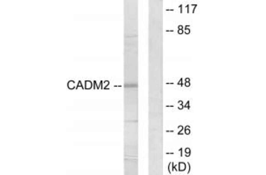 Western blot - CADM2 Antibody from Signalway Antibody (34182) - Antibodies.com