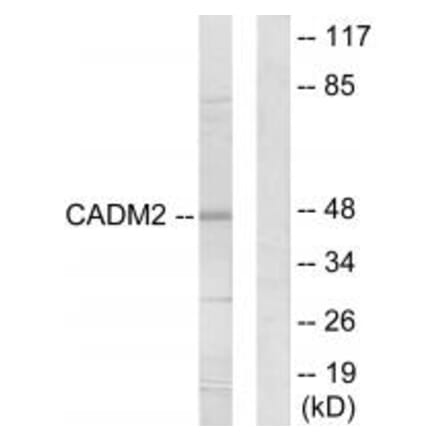 Western blot - CADM2 Antibody from Signalway Antibody (34182) - Antibodies.com