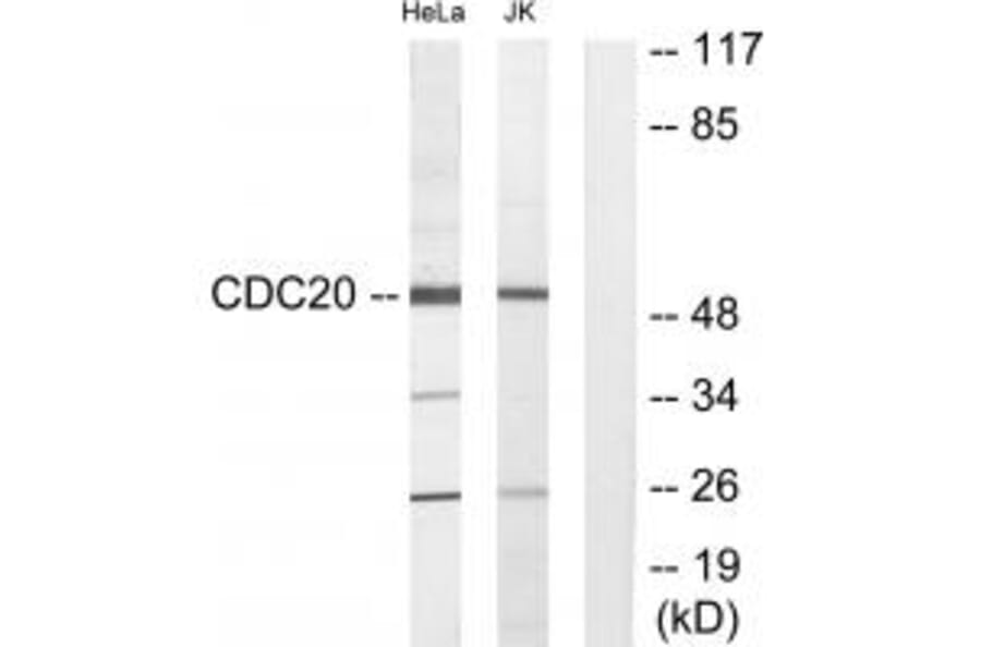 Western blot - CDC20 Antibody from Signalway Antibody (34189) - Antibodies.com