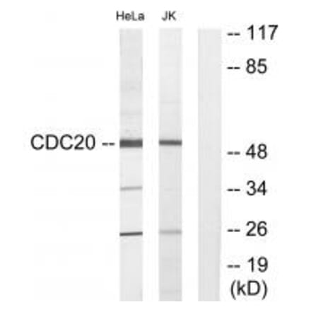 Western blot - CDC20 Antibody from Signalway Antibody (34189) - Antibodies.com